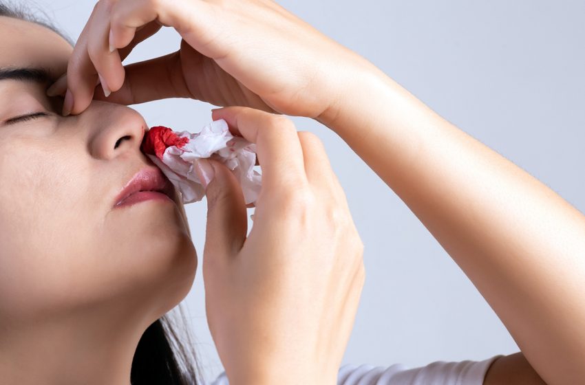  چگونه از خونریزی بینی یا خون دماغ جلوگیری کنیم؟