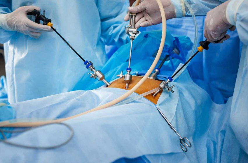  عمل جراحی لاپاراسکوپی چیست؟