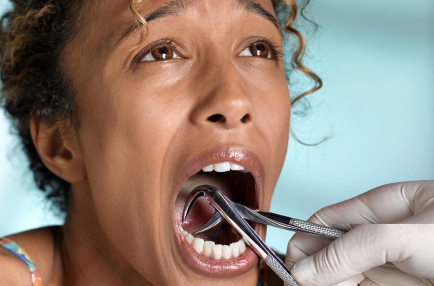 پوسیدگی دندان شایع ترین بیماری عفونی پس از سرماخوردگی!